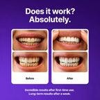Before and after comparison of teeth whitening with text on a purple background