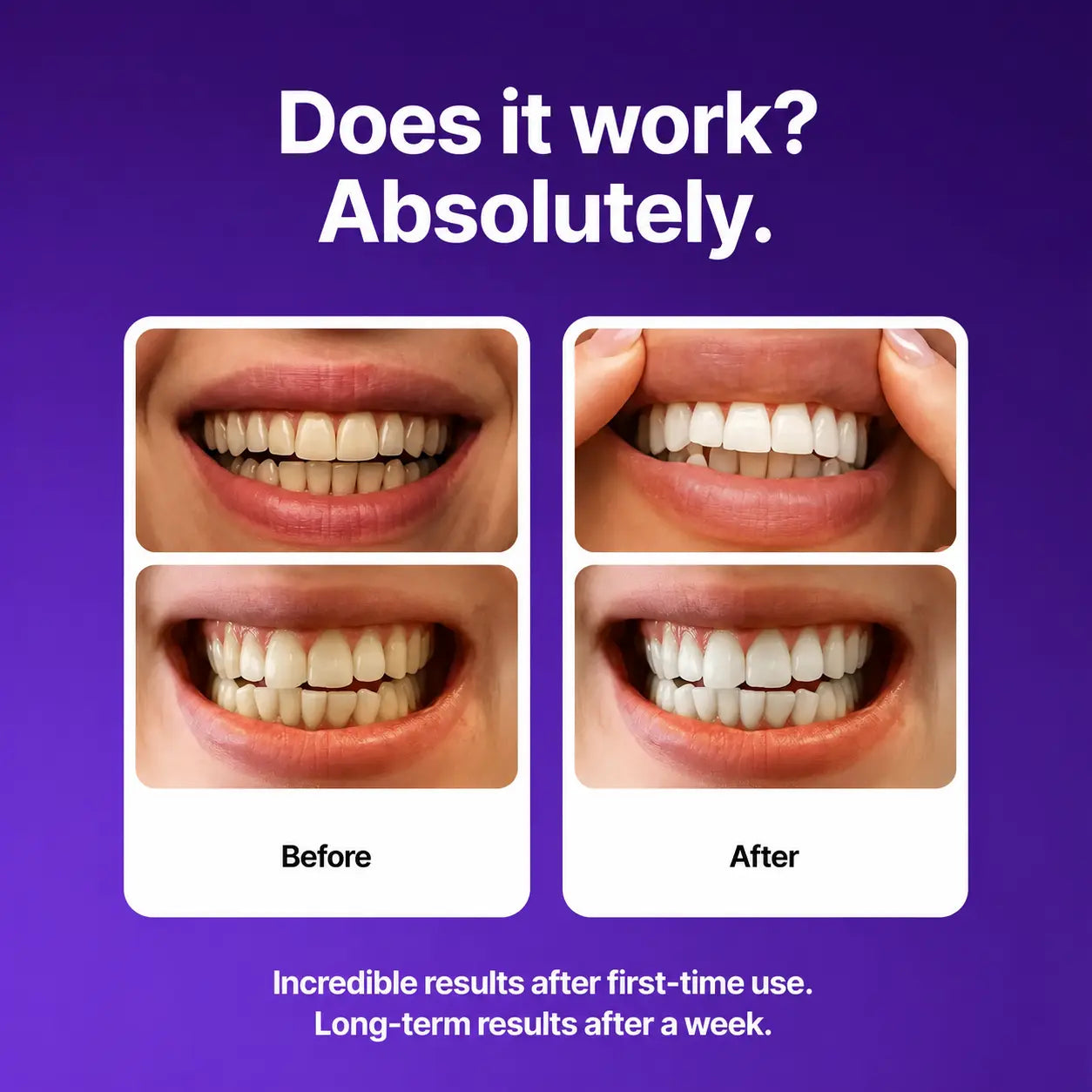 Before and after comparison of teeth whitening with text on a purple background