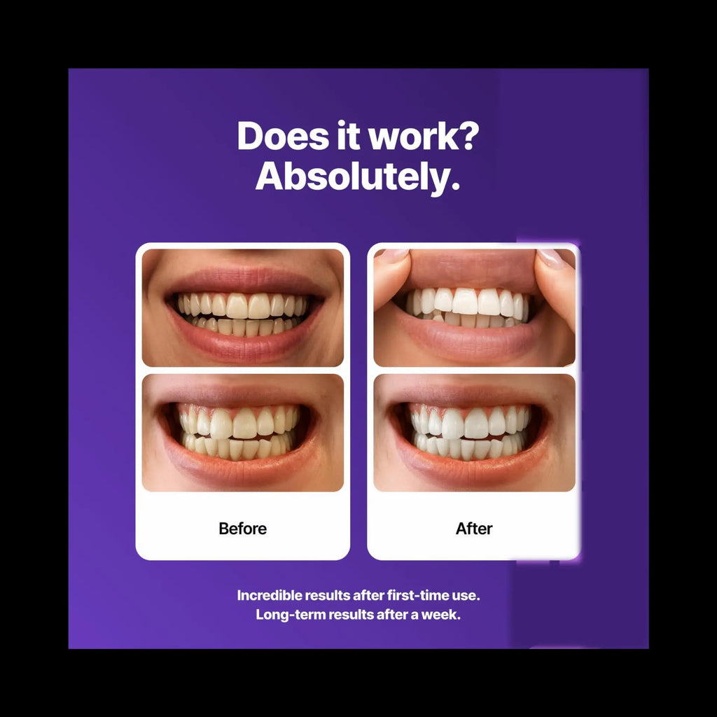 Thunderbird White whitening strips - smile results