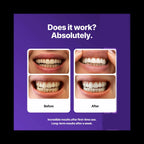 Thunderbird White whitening strips - smile results
